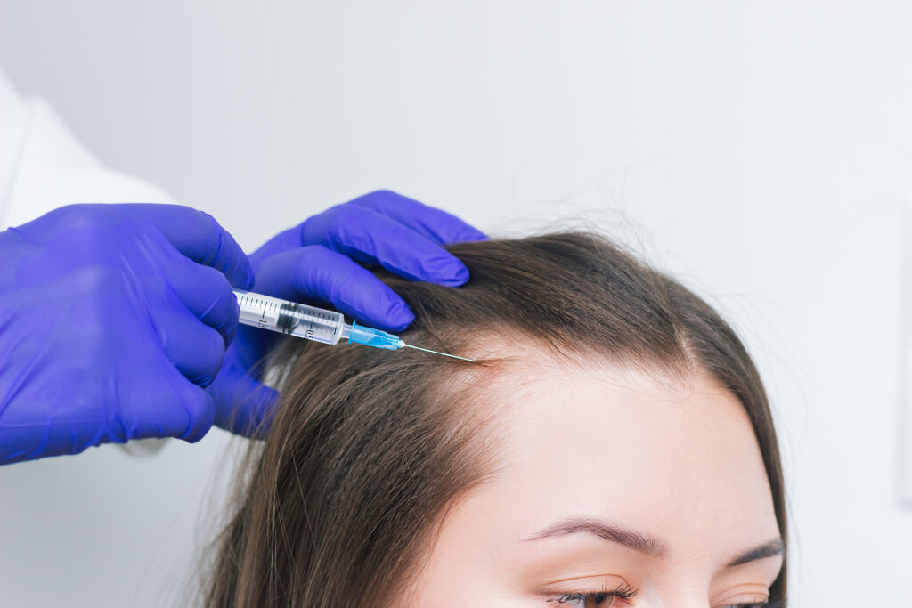 young brunette woman suffering hair loss receiving injections into scalp hair growth
