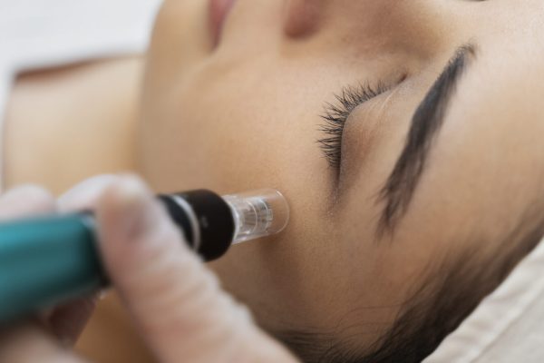 Микронидлинг Dermapen
